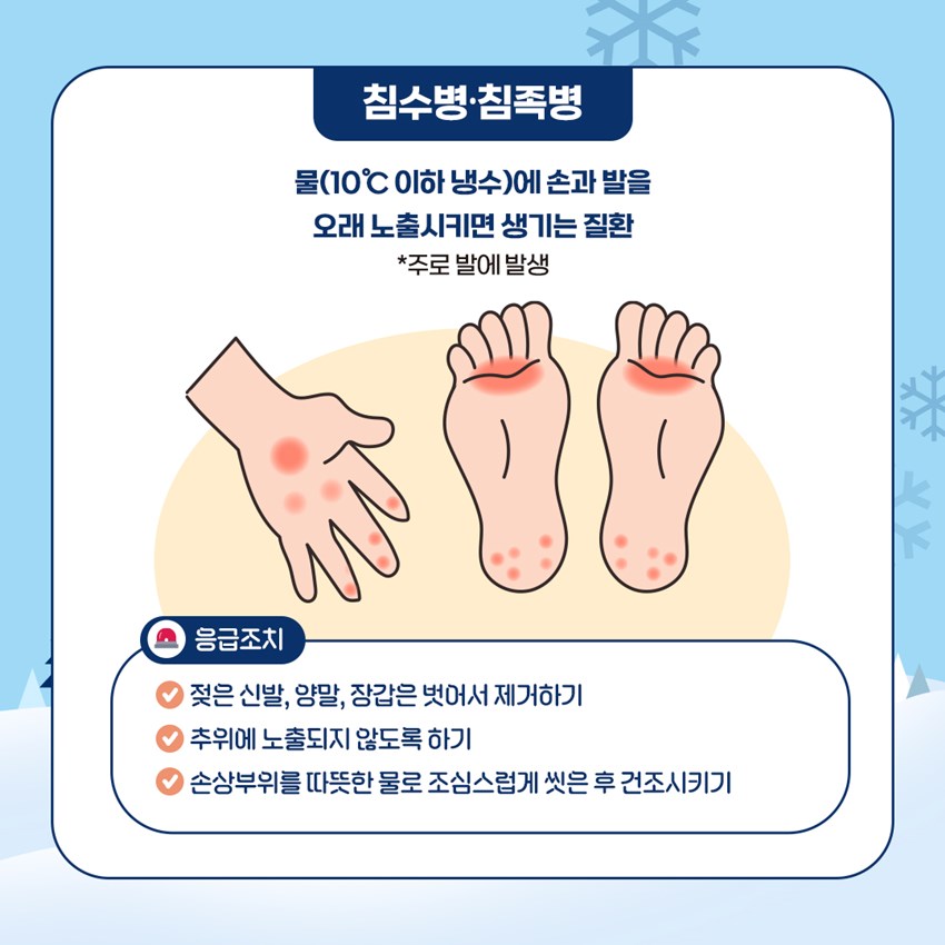 침수병·침족병 물(10℃ 이하 냉수)에 손과 발을 오래 노출시키면 생기는 질환 *주로 발에 발생 응급조치 - 젖은 신발, 양말, 장갑은 벗어서 제거하기 - 추위에 노출되지 않도록 하기 - 손상부위를 따뜻한 물로 조심스럽게 씻은 후 건조시키기